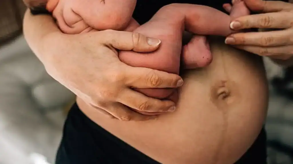 Why Is My Stomach Still Big After Pregnancy Kingston-upon-Hull?